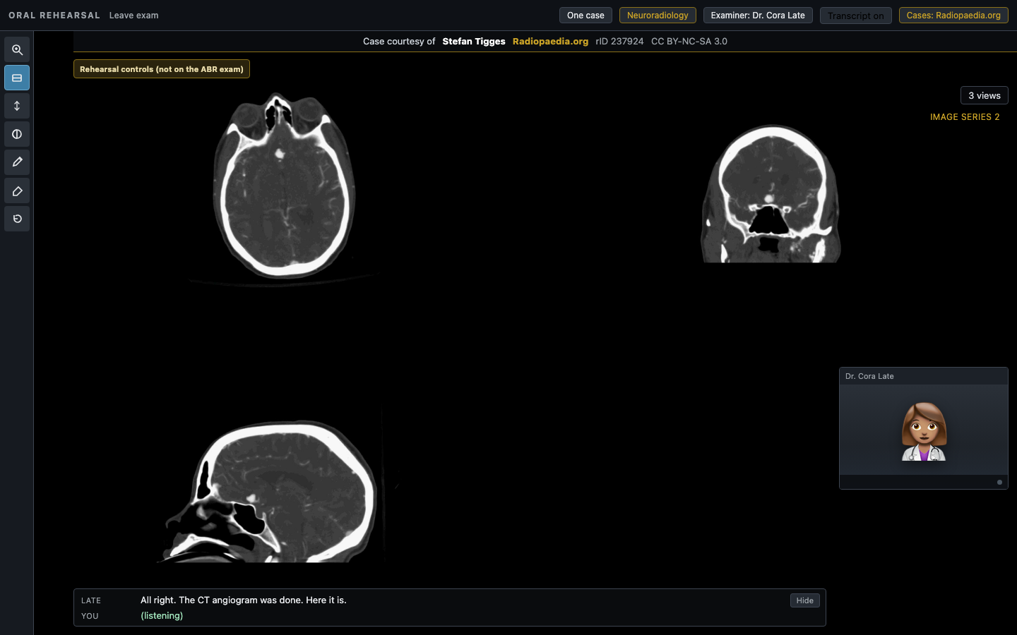 The exam room during a case: a non-contrast head CT on screen, the examiner tile, and the transcript strip along the bottom.
